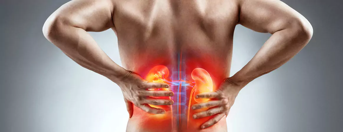 Ayurvedic Treatment for Kidney Stones in Kothapet, Hyderabad – Ayur Harsha